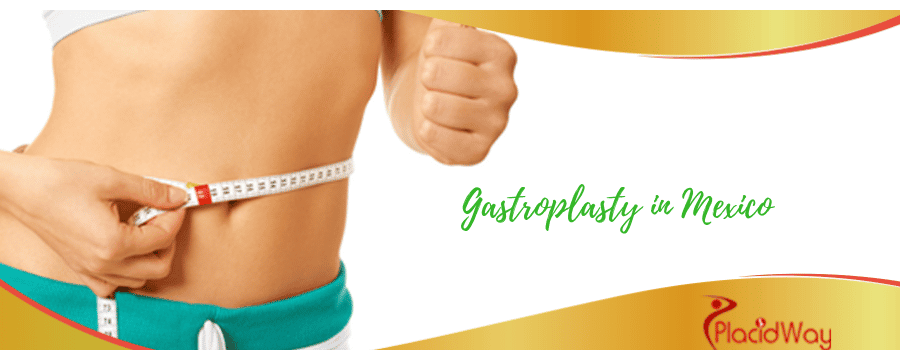 Gastroplasty in Mexico